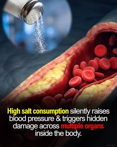 How Processed Sodium Stiffens Your Arteries
